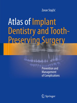 cover image of Atlas of Implant Dentistry and Tooth-Preserving Surgery